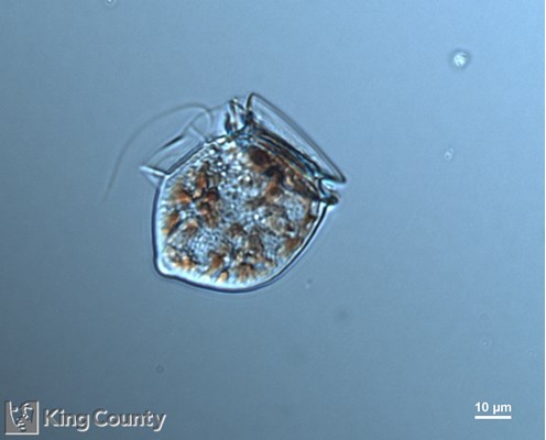 Photo of Dinophysis acuta/Dinophysis norvegica